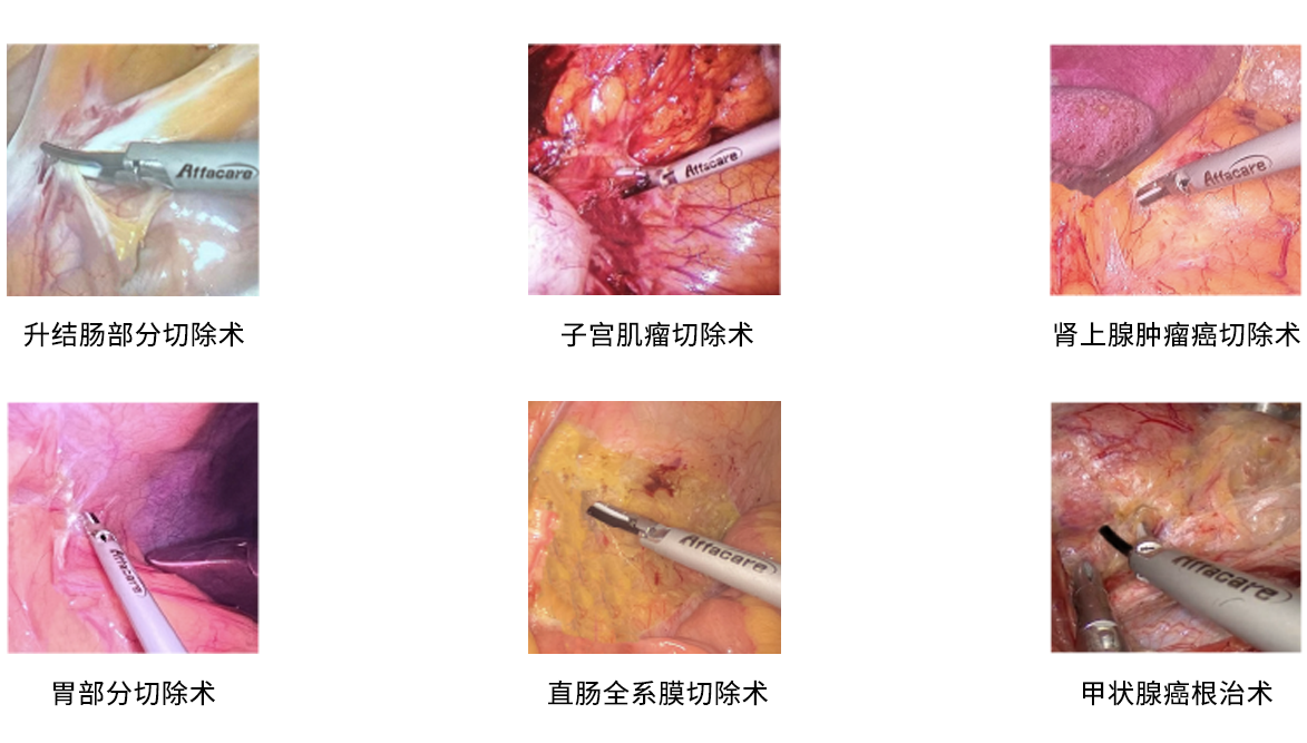 1200臨床案例.png